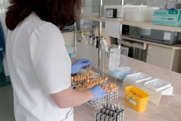 CBC Blood test Price